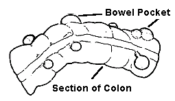 bowel pocket - section of colon