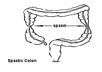 spasm - spastic colon