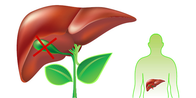 Things you must know if you don’t have a gallbladder