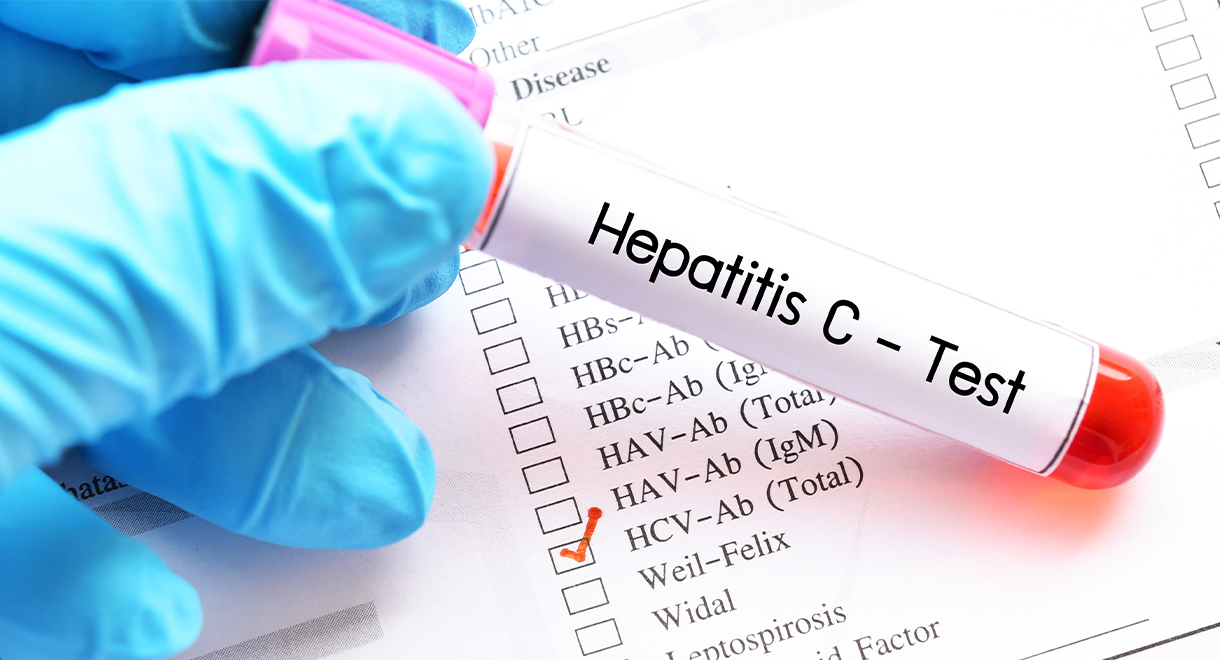 Hepatitis C – an interesting case history