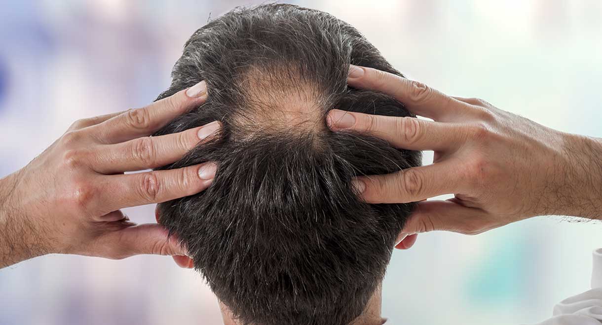 Cream male loss progesterone hair Hair Loss