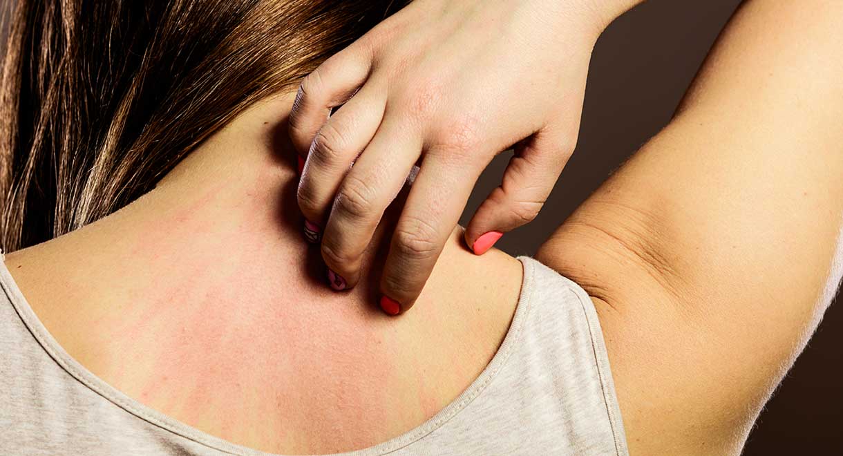 In Some People Gluten Can Cause An Itchy Skin Rash