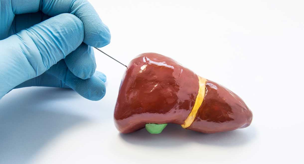 Liver Biopsy