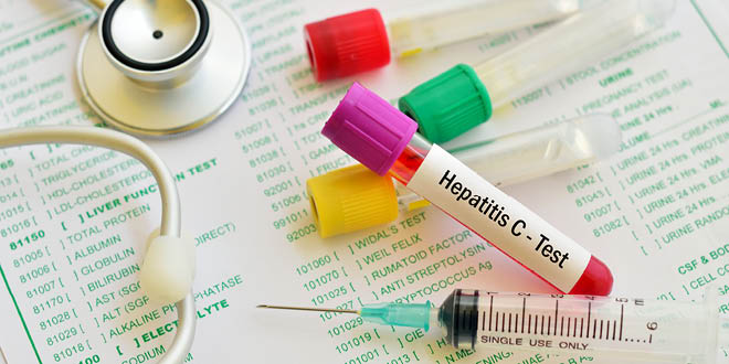 Hepatitis C Virus – it is time to act