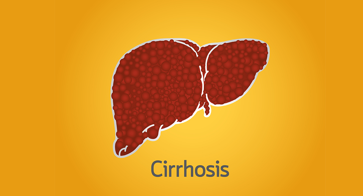 Cirrhosis – How Can We Help It?