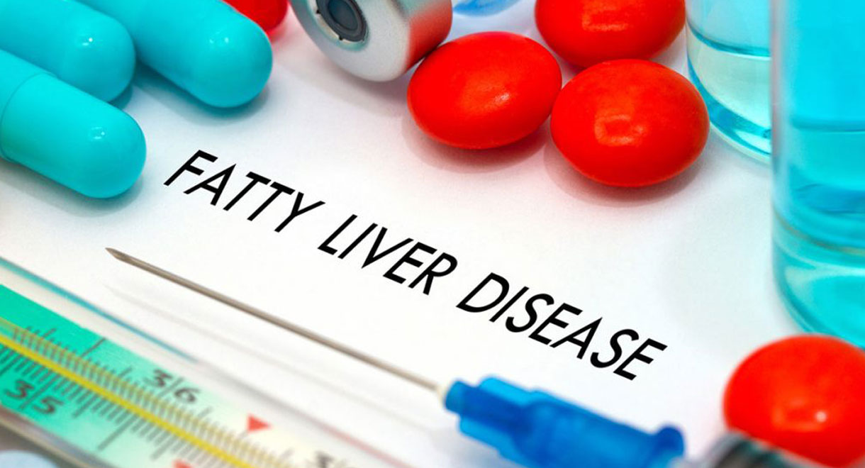 Fatty Liver Epidemic Is Rising