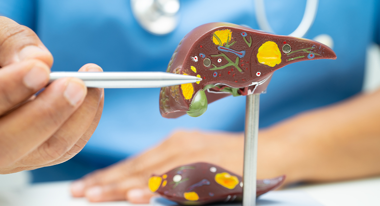 Case Study: Fatty Liver And Gallstones