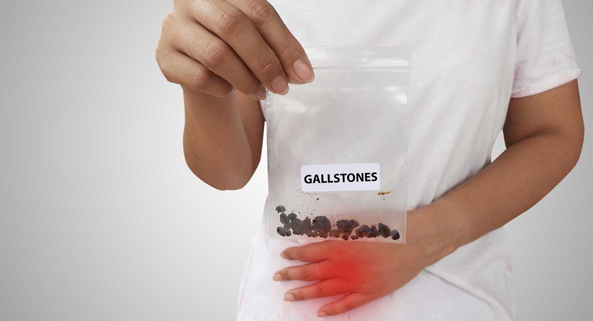 Would You Know If You Had Gallstones?
