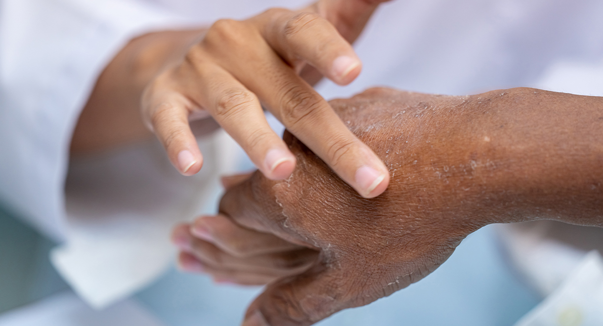 Is Gluten Harming Your Skin?