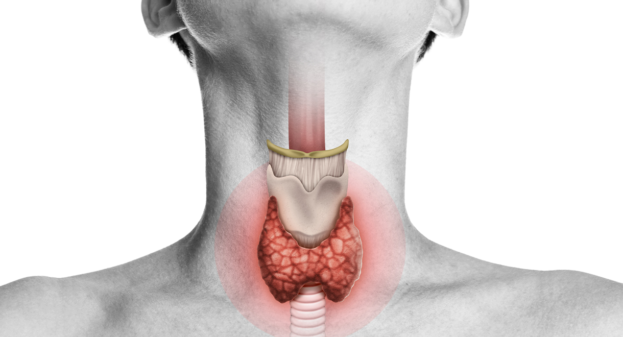 What You Must Know If You've Had Your Thyroid Removed