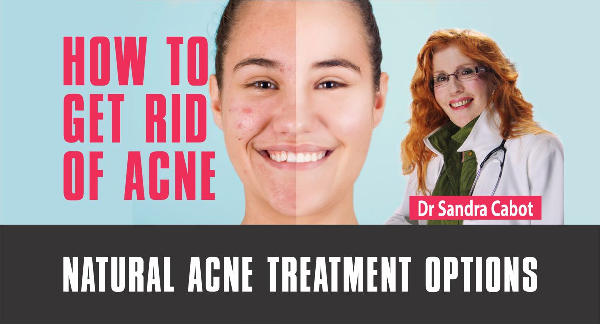 Video | How To Get Rid Of Acne Forever