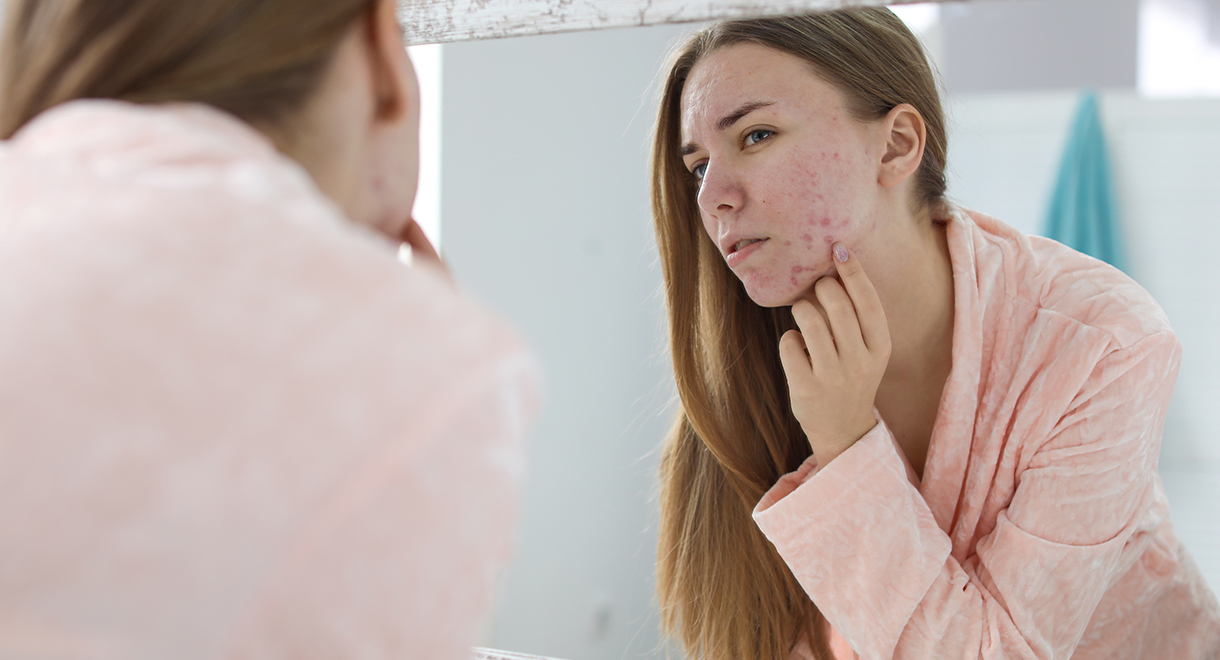 Case Study: Overcoming Acne And Psoriasis