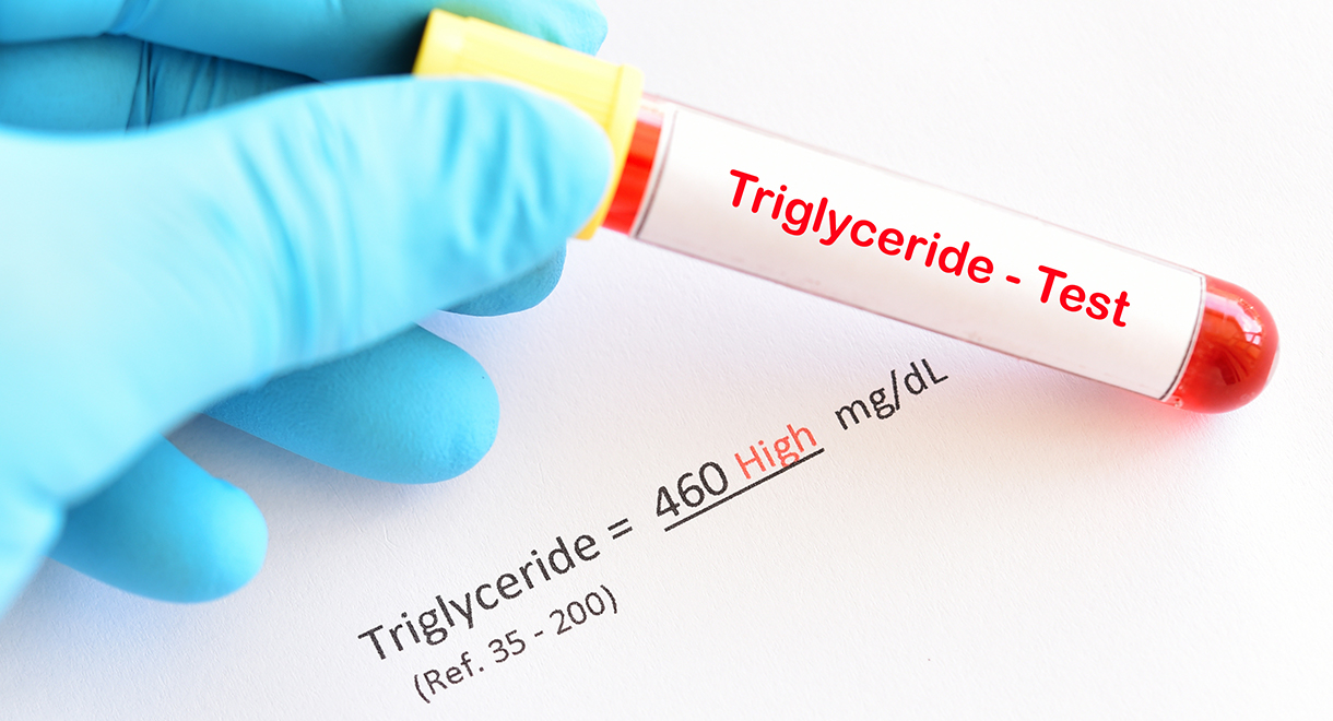 High Triglycerides Are More Dangerous Than High Cholesterol