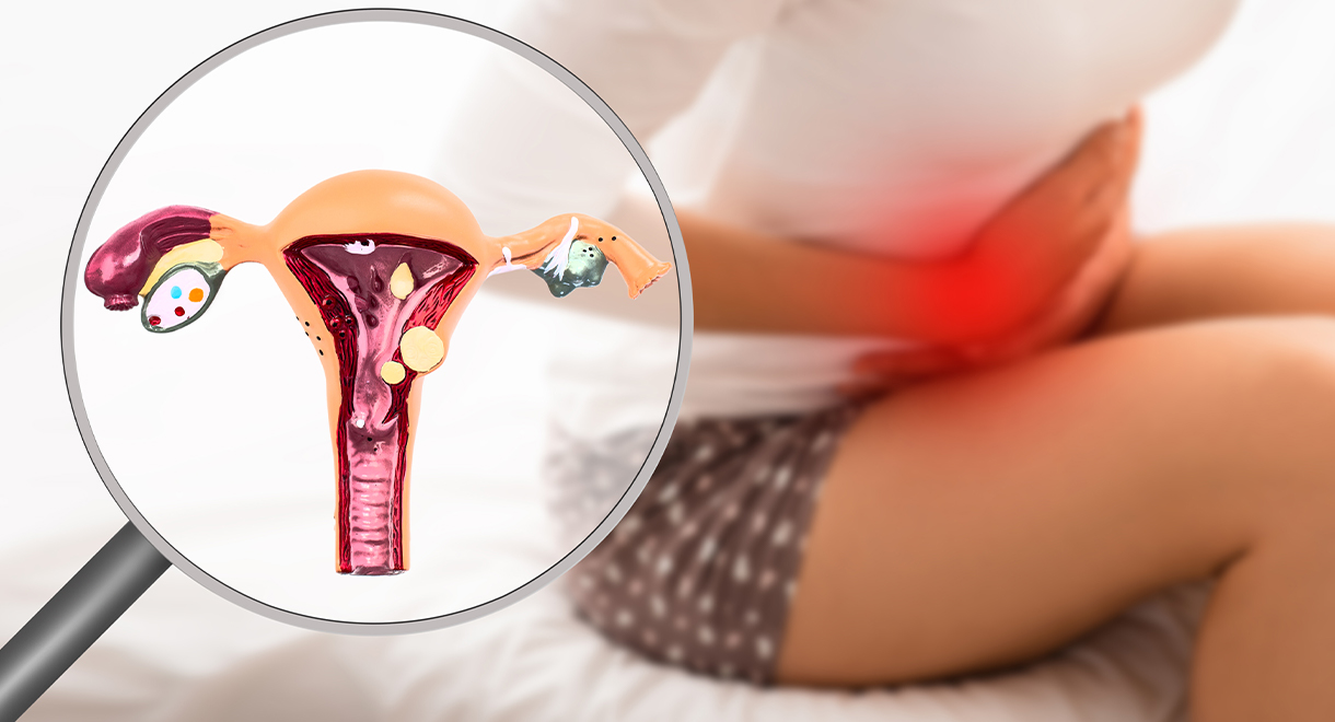 Endometriosis Increases The Risk Of Gestational Diabetes