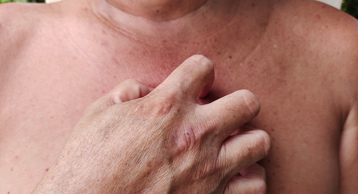 These Skin Conditions May Be A Diabetes Warning