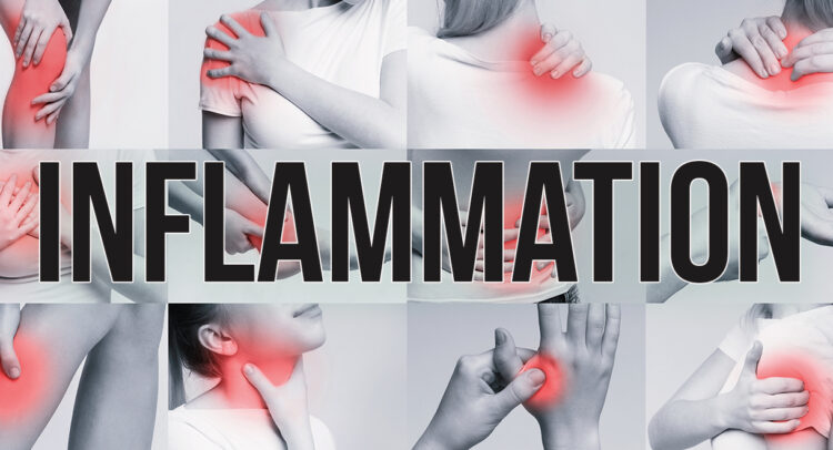 Inflammation Raises The Risk Of Cancer