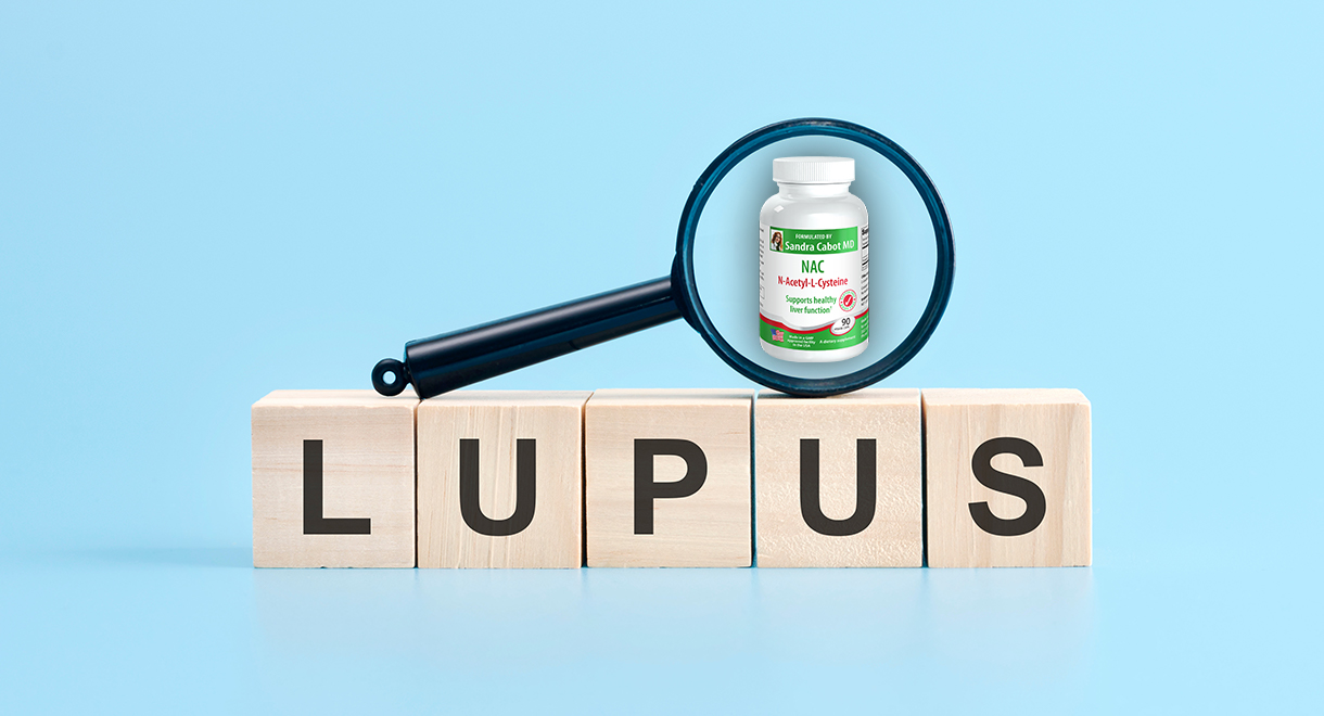 N-Acetyl Cysteine (NAC) Helps Manage Systemic Lupus Erythematosus