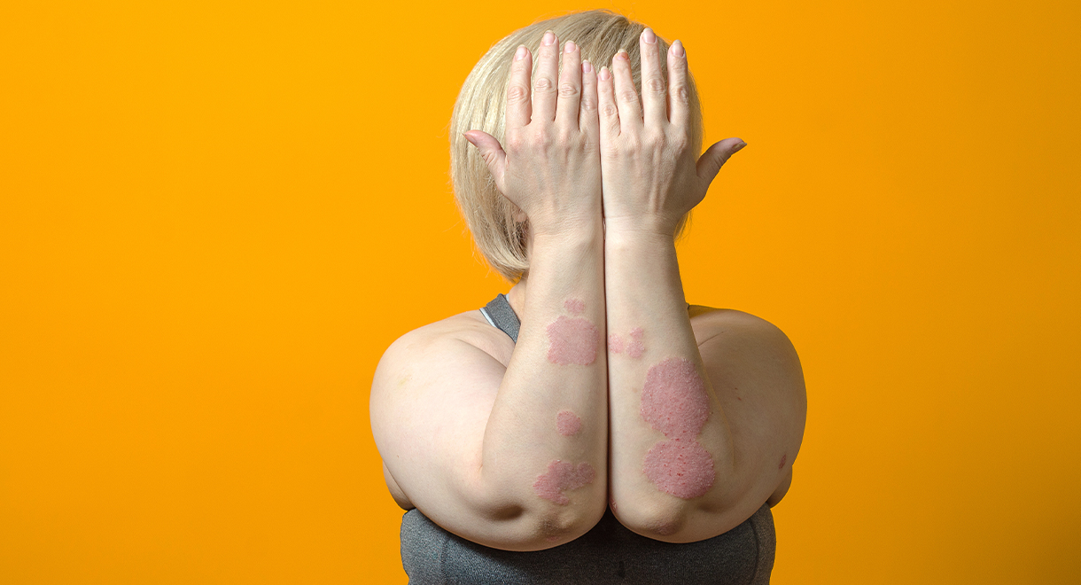 Diabetics With Skin Condition May Be At Risk Of Kidney Disease