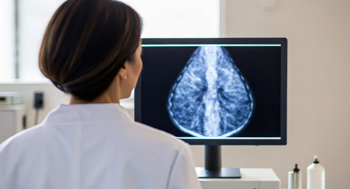 Higher Breast Density May Mean More Breast Cancer